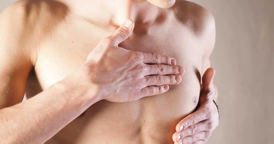 Male Breast Cancer: Understanding the Rare Yet Significant Condition